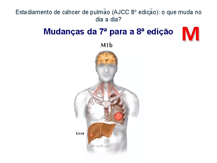 Estadiamento de ca ncer de pulma o (AJCC 8 a edic a o): o