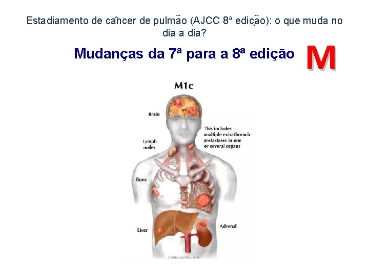 Estadiamento de ca ncer de pulma o (AJCC 8 a edic a o): o
