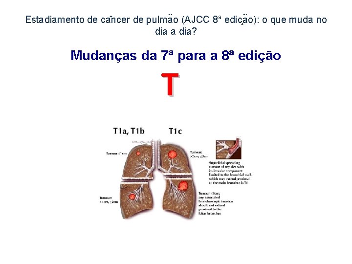 Estadiamento de ca ncer de pulma o (AJCC 8 a edic a o): o