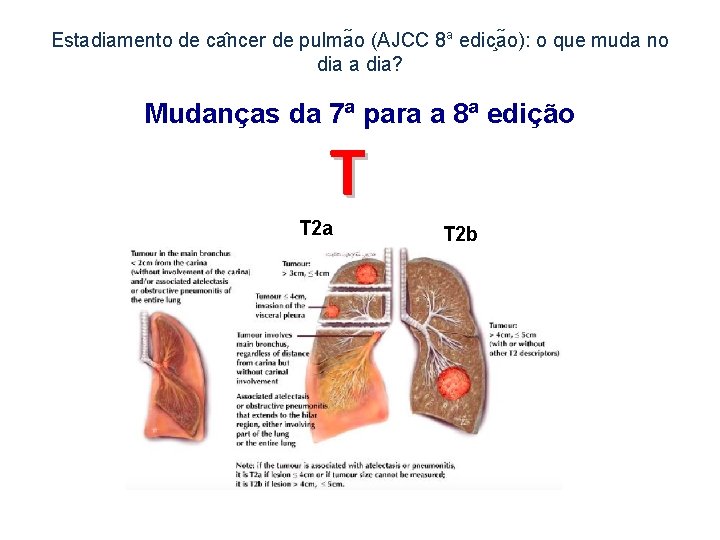 Estadiamento de ca ncer de pulma o (AJCC 8 a edic a o): o