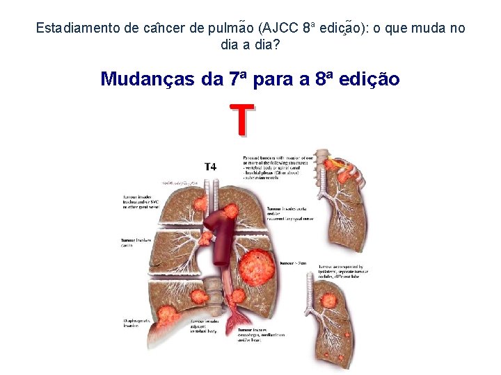 Estadiamento de ca ncer de pulma o (AJCC 8 a edic a o): o