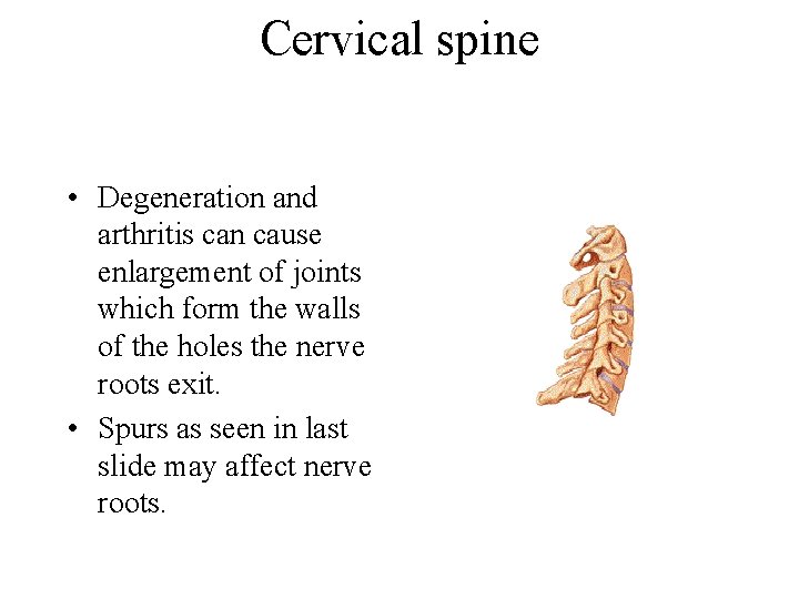 Cervical spine • Degeneration and arthritis can cause enlargement of joints which form the