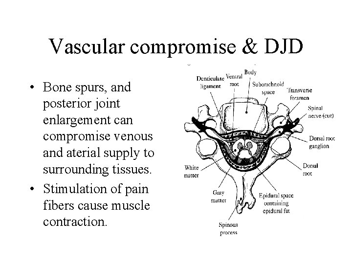 Vascular compromise & DJD • Bone spurs, and posterior joint enlargement can compromise venous