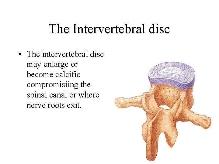 The Intervertebral disc • The intervertebral disc may enlarge or become calcific compromisiing the