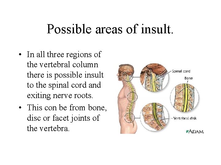 Possible areas of insult. • In all three regions of the vertebral column there