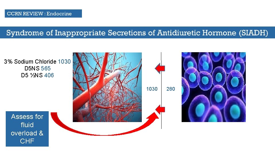 3% Sodium Chloride 1030 D 5 NS 565 D 5 ½NS 406 1030 Assess