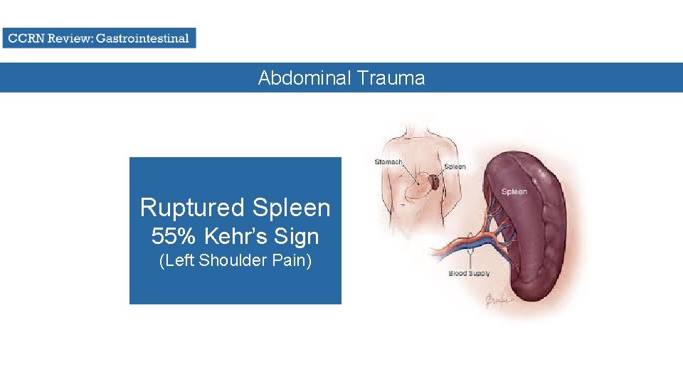 Abdominal Trauma Ruptured Spleen 55% Kehr’s Sign (Left Shoulder Pain) 