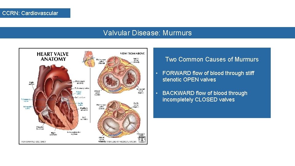 CCRN: Cardiovascular Valvular Disease: Murmurs Two Common Causes of Murmurs • FORWARD flow of