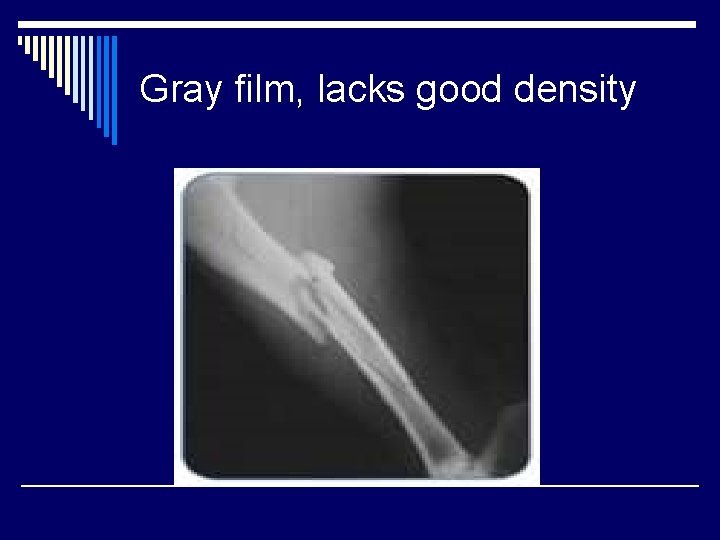 Gray film, lacks good density 