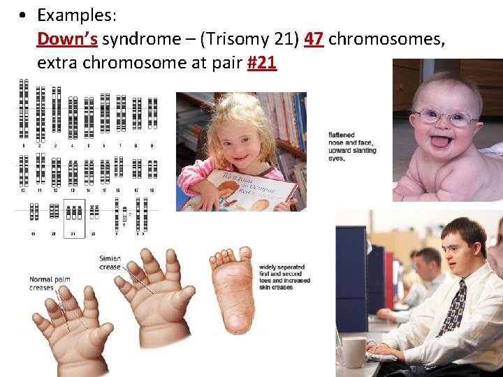  • Examples: Down’s syndrome – (Trisomy 21) 47 chromosomes, extra chromosome at pair