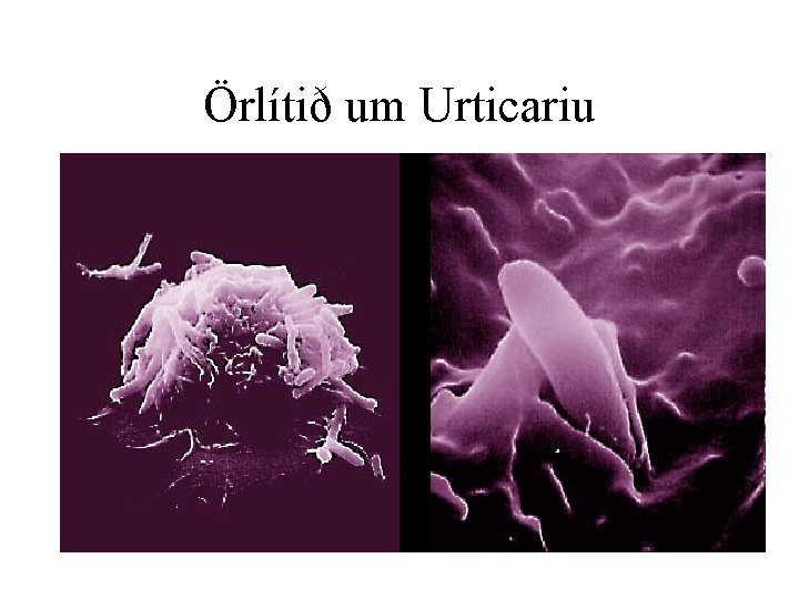 Örlítið um Urticariu 