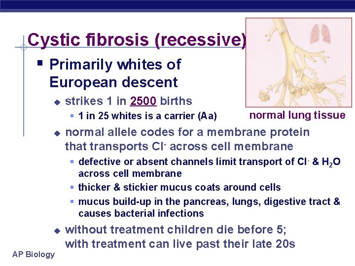 Cystic fibrosis (recessive) § Primarily whites of European descent u strikes 1 in 2500