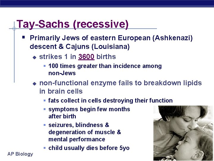 Tay-Sachs (recessive) § Primarily Jews of eastern European (Ashkenazi) descent & Cajuns (Louisiana) u