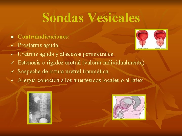 Sondas Vesicales n ü ü ü Contraindicaciones: Prostatitis aguda. Uretritis aguda y abscesos periuretrales