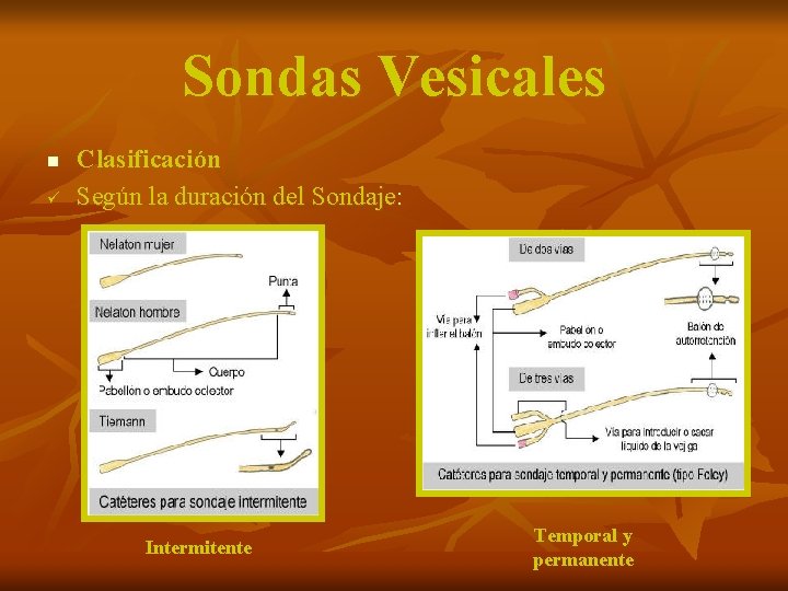 Sondas Vesicales n ü Clasificación Según la duración del Sondaje: Intermitente Temporal y permanente