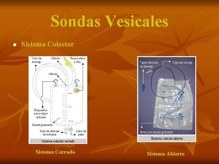 Sondas Vesicales n Sistema Colector Sistema Cerrado Sistema Abierto 