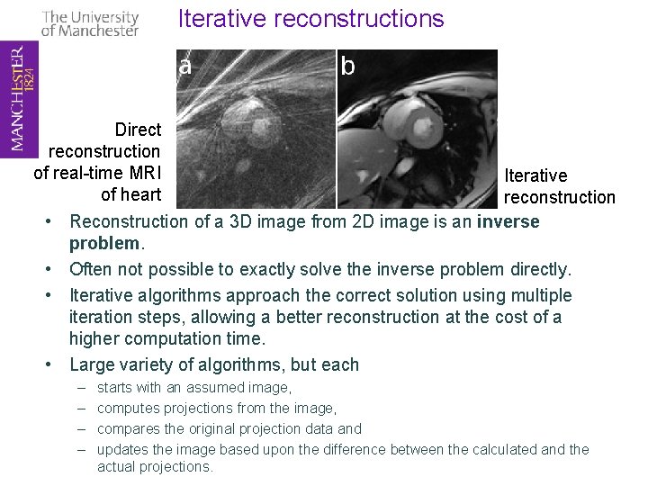 Iterative reconstructions Direct reconstruction of real-time MRI of heart • • Iterative reconstruction Reconstruction