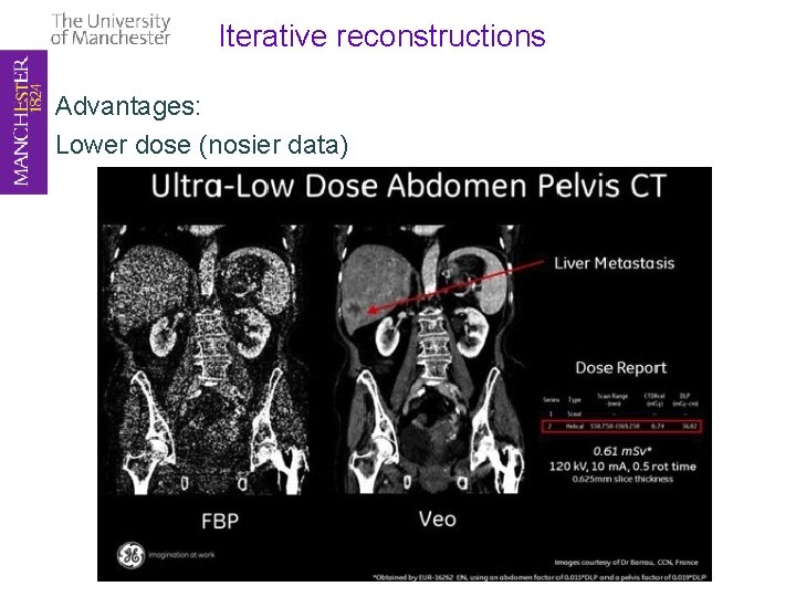 Iterative reconstructions Advantages: Lower dose (nosier data) 