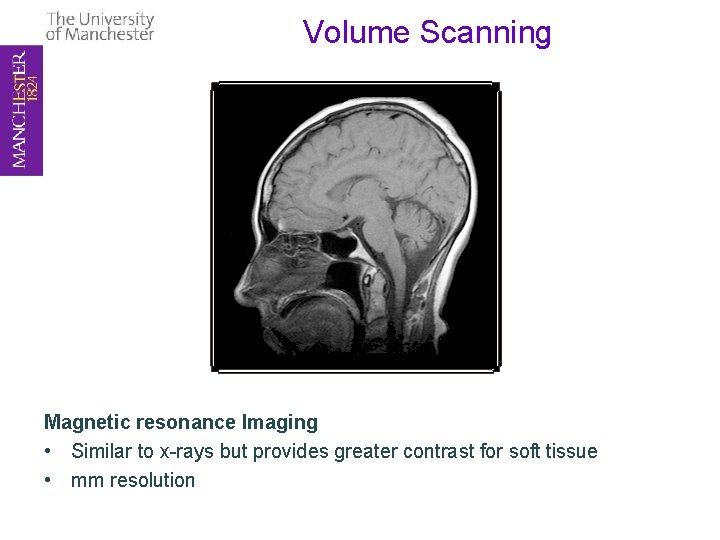 Volume Scanning Magnetic resonance Imaging • Similar to x-rays but provides greater contrast for