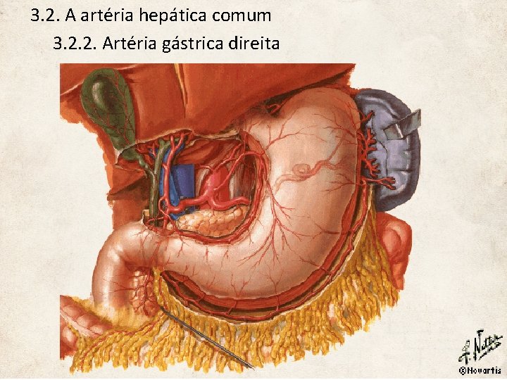 3. 2. A artéria hepática comum 3. 2. 2. Artéria gástrica direita 