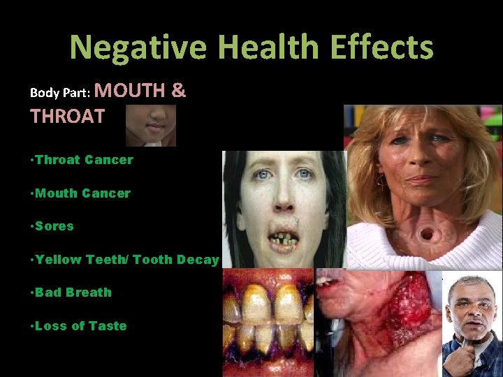 Negative Health Effects Body Part: MOUTH THROAT & • Throat Cancer • Mouth Cancer