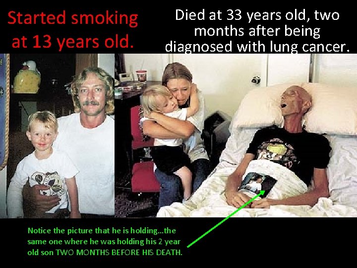 Started smoking at 13 years old. Died at 33 years old, two months after