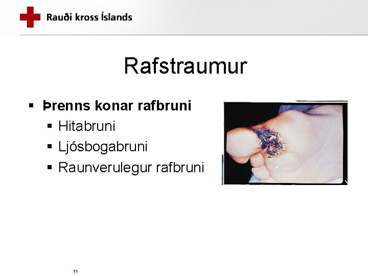 Rafstraumur § Þrenns konar rafbruni § Hitabruni § Ljósbogabruni § Raunverulegur rafbruni 11 