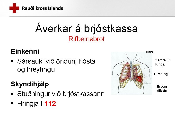 Áverkar á brjóstkassa Rifbeinsbrot Einkenni § Sársauki við öndun, hósta og hreyfingu Skyndihjálp §