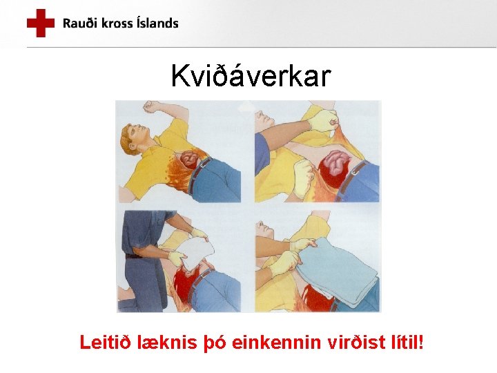 Kviðáverkar Leitið læknis þó einkennin virðist lítil! 