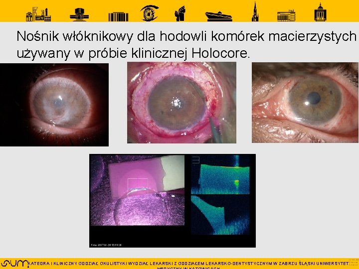 Nośnik włóknikowy dla hodowli komórek macierzystych używany w próbie klinicznej Holocore. CC BY 4. Nośnik włóknikowy dla hodowli komórek macierzystych używany w próbie klinicznej Holocore. CC BY 4.