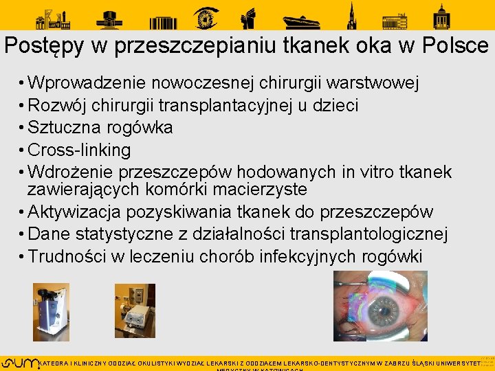 Postępy w przeszczepianiu tkanek oka w Polsce • Wprowadzenie nowoczesnej chirurgii warstwowej • Rozwój Postępy w przeszczepianiu tkanek oka w Polsce • Wprowadzenie nowoczesnej chirurgii warstwowej • Rozwój