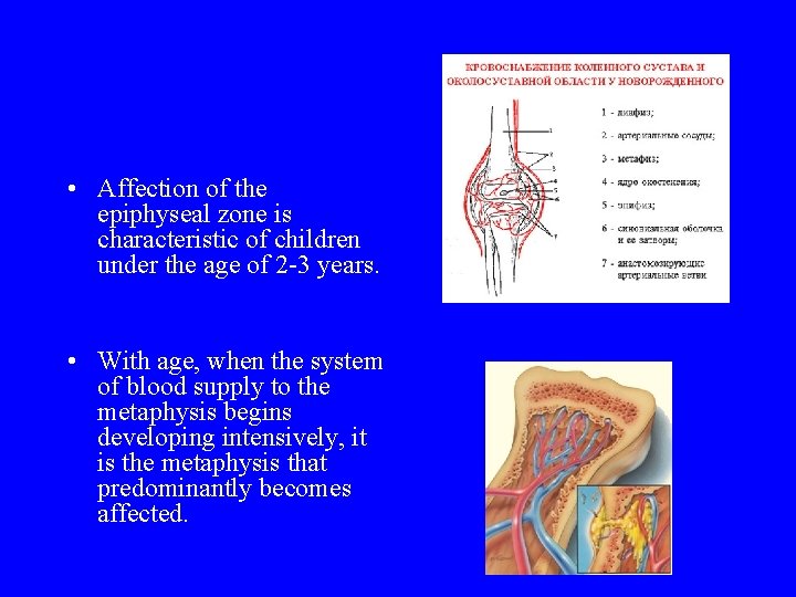 • Affection of the epiphyseal zone is characteristic of children under the age • Affection of the epiphyseal zone is characteristic of children under the age
