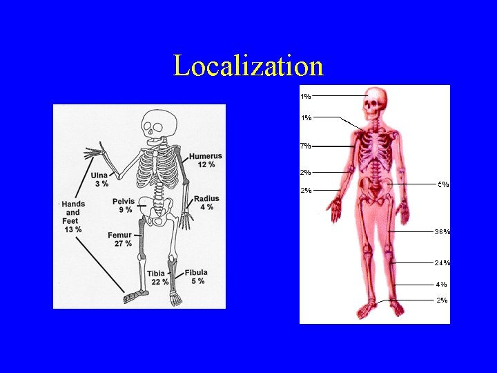Localization Localization