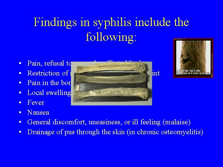 Findings in syphilis include the following: • • Pain, refusal to move the affected Findings in syphilis include the following: • • Pain, refusal to move the affected