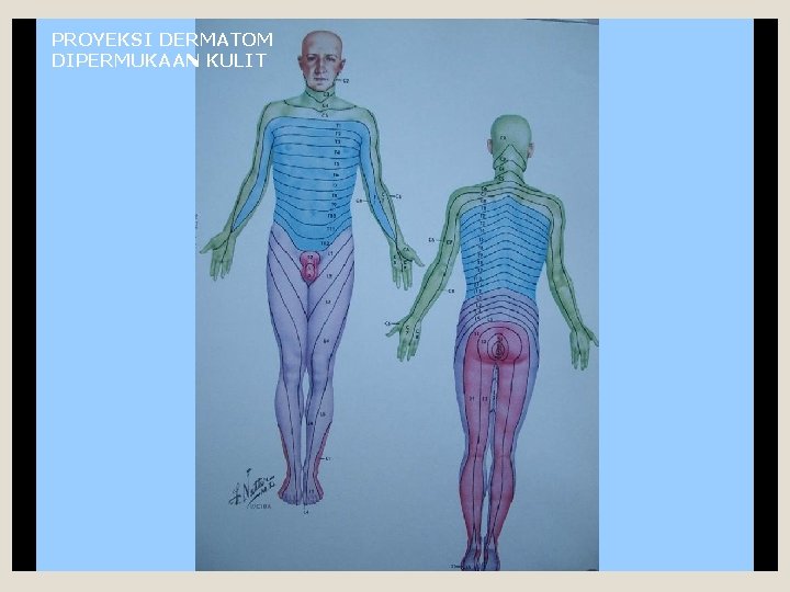 PROYEKSI DERMATOM DIPERMUKAAN KULIT 