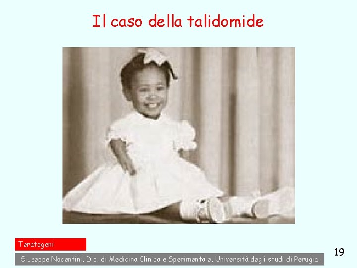 Il caso della talidomide Teratogeni Giuseppe Nocentini, Dip. di Medicina Clinica e Sperimentale, Università Il caso della talidomide Teratogeni Giuseppe Nocentini, Dip. di Medicina Clinica e Sperimentale, Università