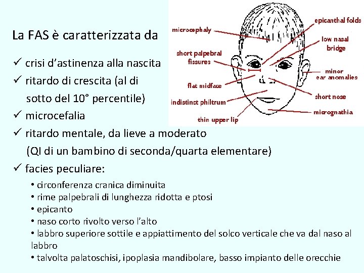 La FAS è caratterizzata da ü crisi d’astinenza alla nascita ü ritardo di crescita La FAS è caratterizzata da ü crisi d’astinenza alla nascita ü ritardo di crescita