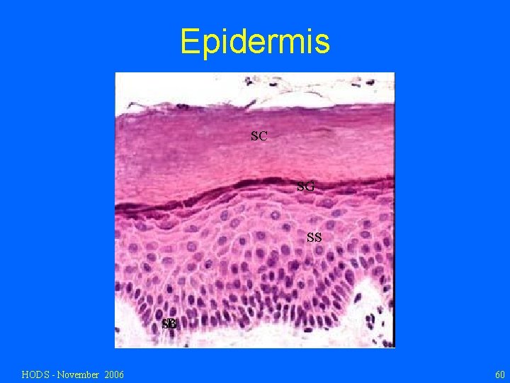 Epidermis SC SG SS B HODS - November 2006 60 