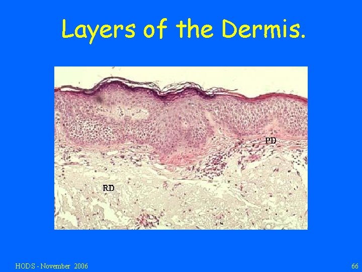 Layers of the Dermis. HODS - November 2006 66 