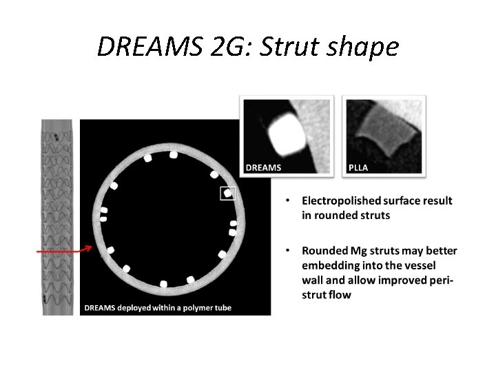 DREAMS 2 G: Strut shape 