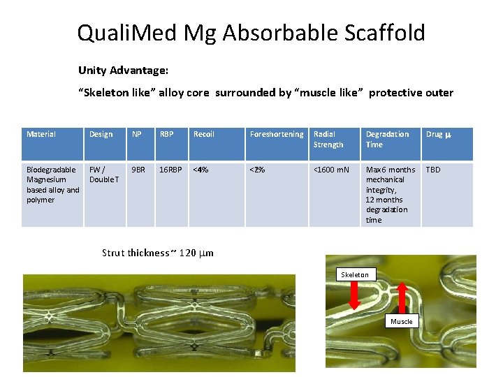 Quali. Med Mg Absorbable Scaffold Unity Advantage: “Skeleton like” alloy core surrounded by “muscle