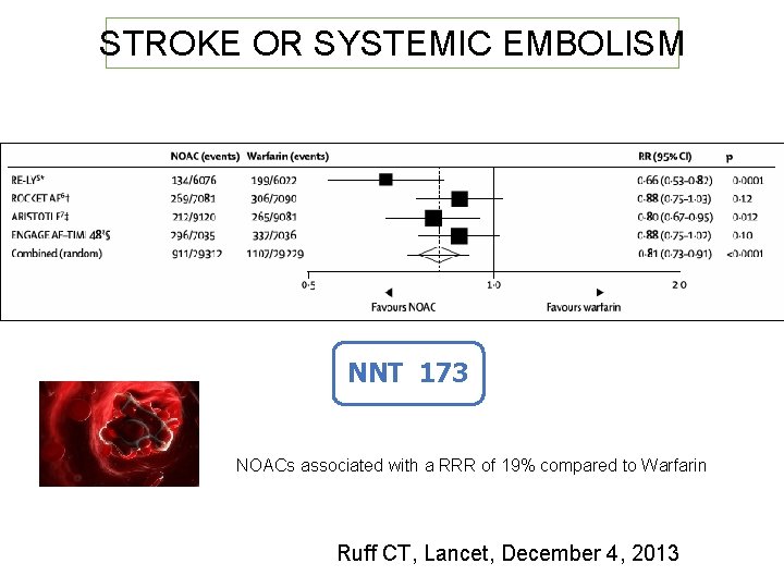 STROKE OR SYSTEMIC EMBOLISM NNT 173 NOACs associated with a RRR of 19% compared