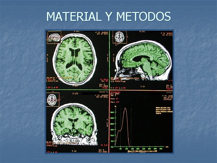 MATERIAL Y METODOS 