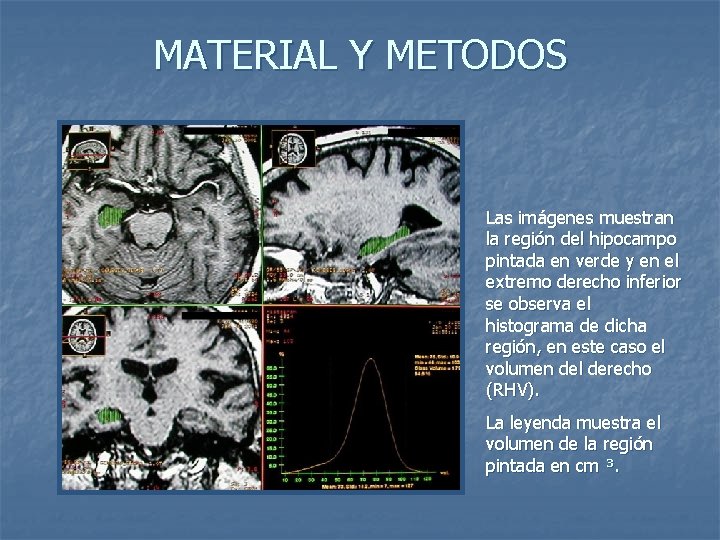MATERIAL Y METODOS Las imágenes muestran la región del hipocampo pintada en verde y