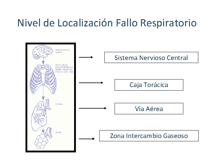 Nivel de Localización Fallo Respiratorio Sistema Nervioso Central Caja Torácica Vía Aérea Zona Intercambio