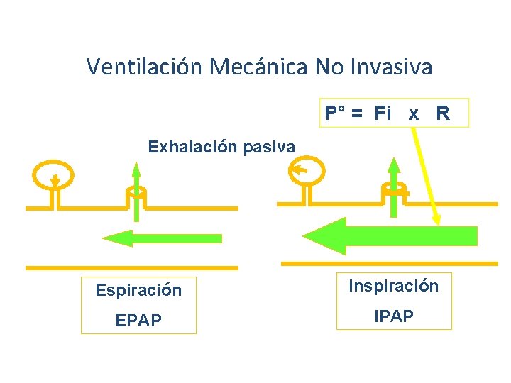 Ventilación Mecánica No Invasiva P° = Fi x R Exhalación pasiva Espiración Inspiración EPAP