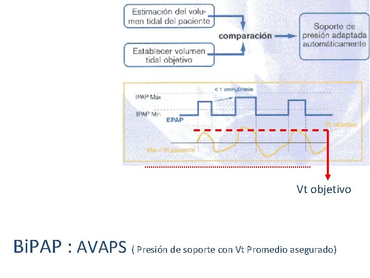 Vt objetivo Bi. PAP : AVAPS ( Presión de soporte con Vt Promedio asegurado)