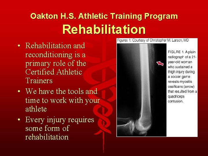 Oakton H. S. Athletic Training Program Rehabilitation • Rehabilitation and reconditioning is a primary