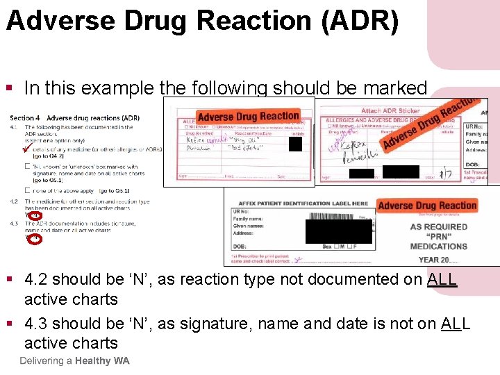 Adverse Drug Reaction (ADR) § In this example the following should be marked § Adverse Drug Reaction (ADR) § In this example the following should be marked §