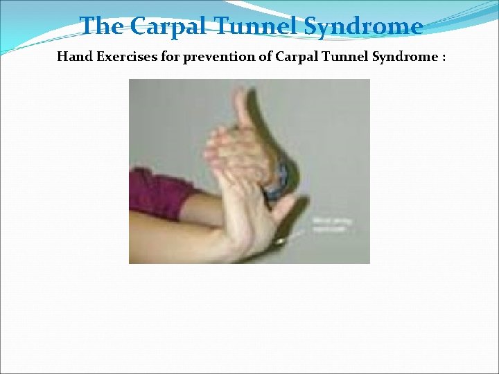 The Carpal Tunnel Syndrome Hand Exercises for prevention of Carpal Tunnel Syndrome : 